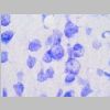 Neuronas Nissl 18.jpg